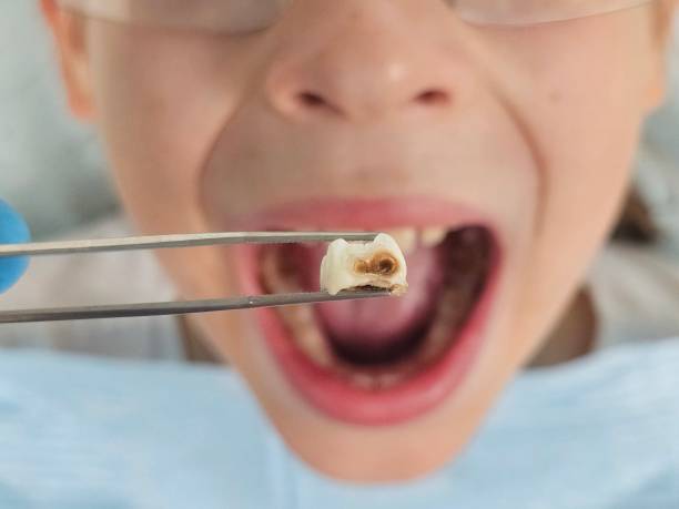 Best Pediatric Emergency Dentist in Midway City, CA